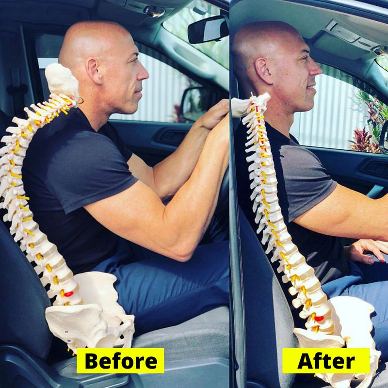 Almofada Ortopédica para Carro - Conforto e Alivio de Dores